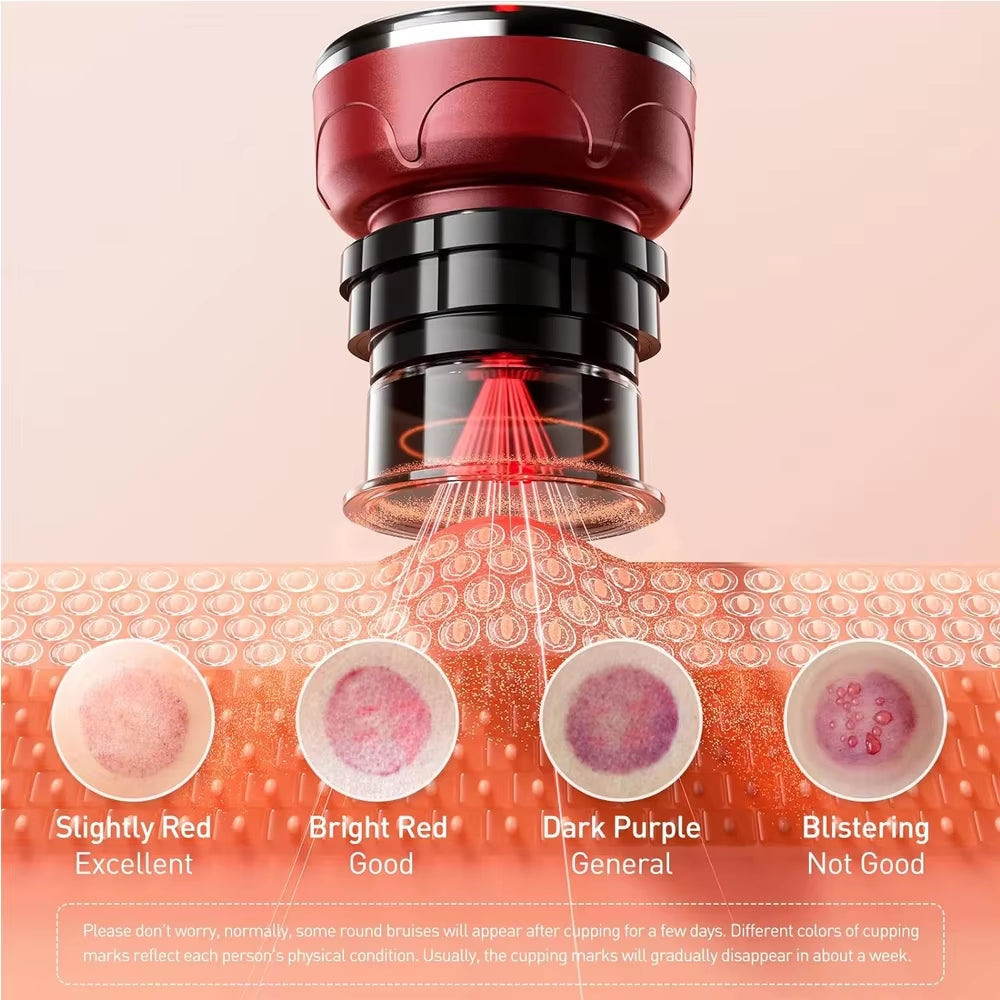Electric Vacuum Cupping Massage 8 Cups Gua Sha Vacuum Suction Cups Anti-Cellulite Therapy Massager for Body Fat Burning Slimming